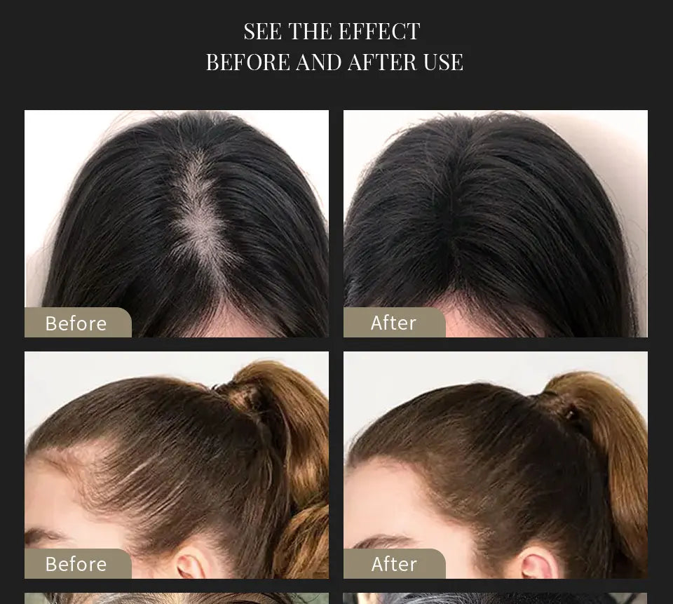 SEVICH Hair Building Fiber Set Cover Sparse Hair Or Bald Spots Hair Loss Regrowth Treatment Keratin Hair Fiber Powder Applicator