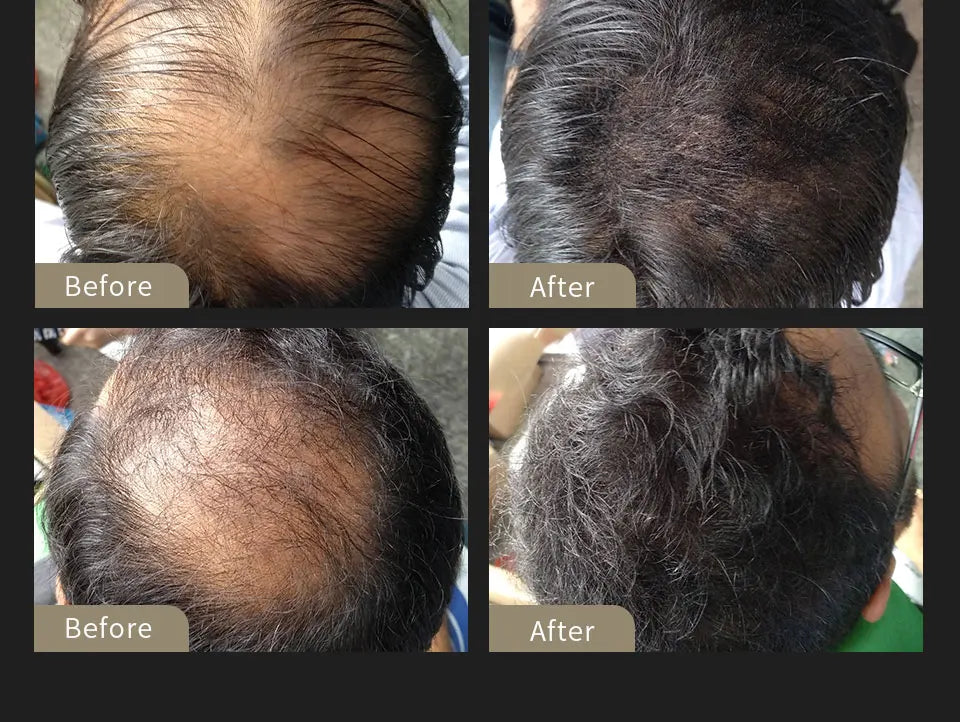 SEVICH Hair Building Fiber Set Cover Sparse Hair Or Bald Spots Hair Loss Regrowth Treatment Keratin Hair Fiber Powder Applicator