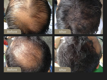 SEVICH Hair Building Fiber Set Cover Sparse Hair Or Bald Spots Hair Loss Regrowth Treatment Keratin Hair Fiber Powder Applicator
